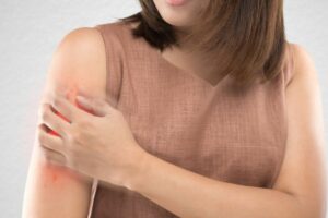 Pielęgnacja skóry z łuszczycą – praktyczne porady